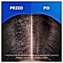 Head & Shoulders Sensitive Scalp Szampon Przeciwłupieżowy 400 ml